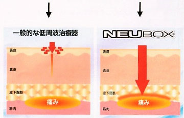 NEUBOX 赤沼整骨院